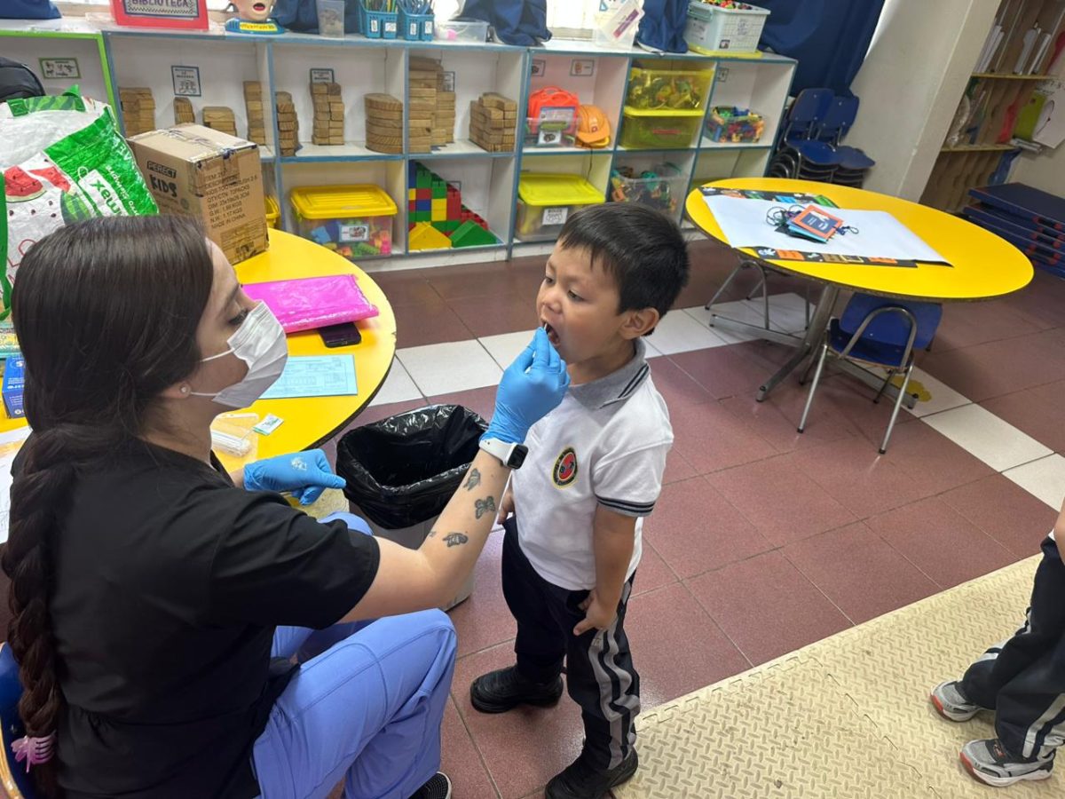 Segunda aplicación de flúor