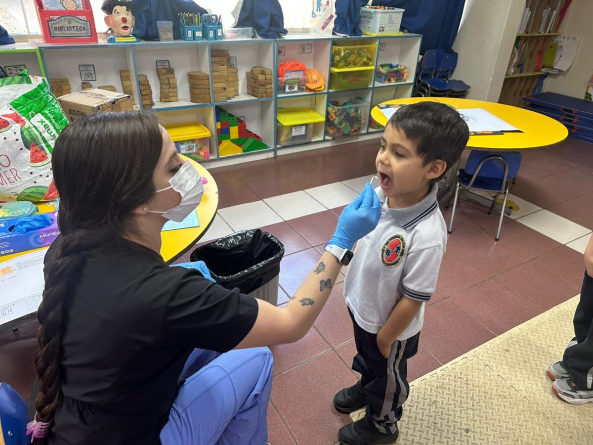 Segunda aplicación de flúor