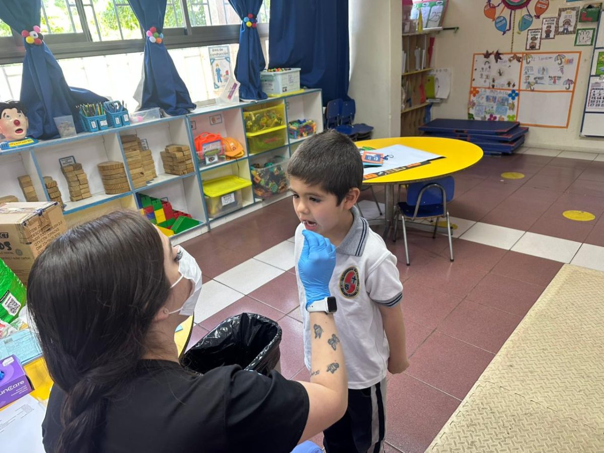 Segunda aplicación de flúor