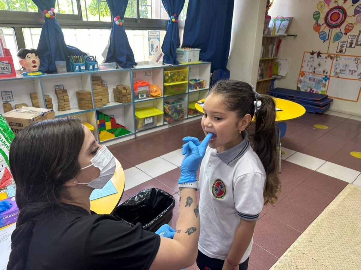 Segunda aplicación de flúor