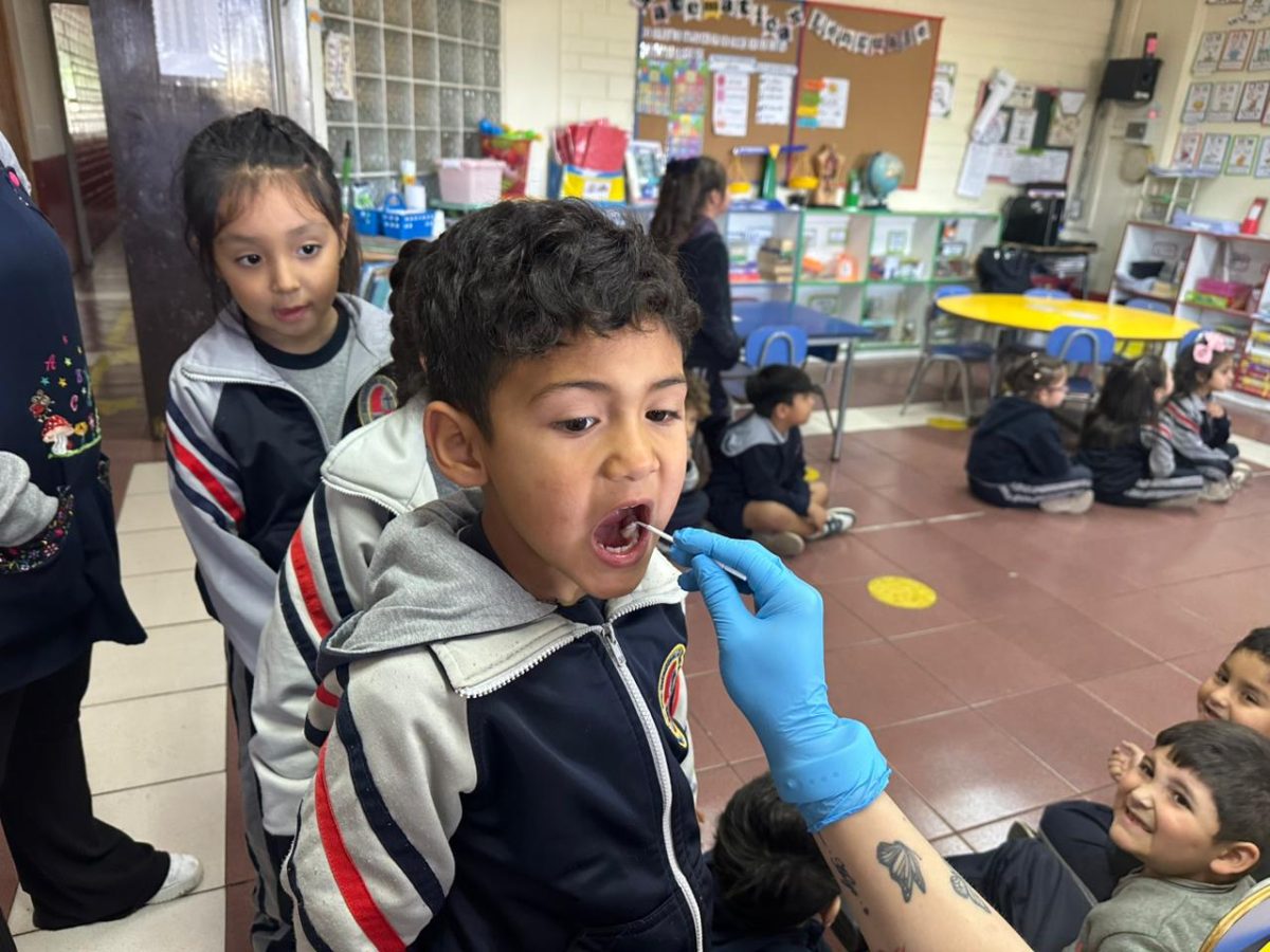 Segunda aplicación de flúor