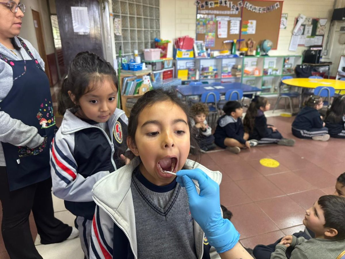 Segunda aplicación de flúor