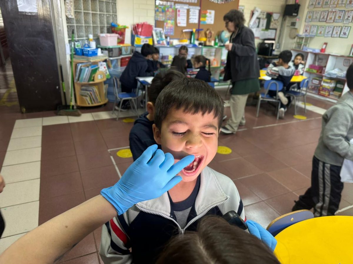 Segunda aplicación de flúor